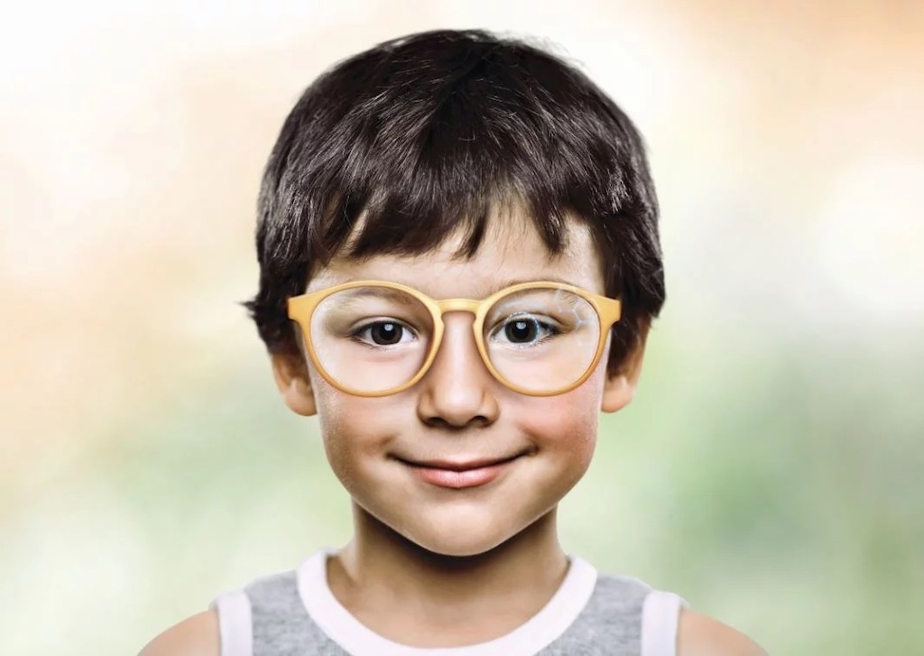 Hoya MiYOSMART Myopia Control Lens