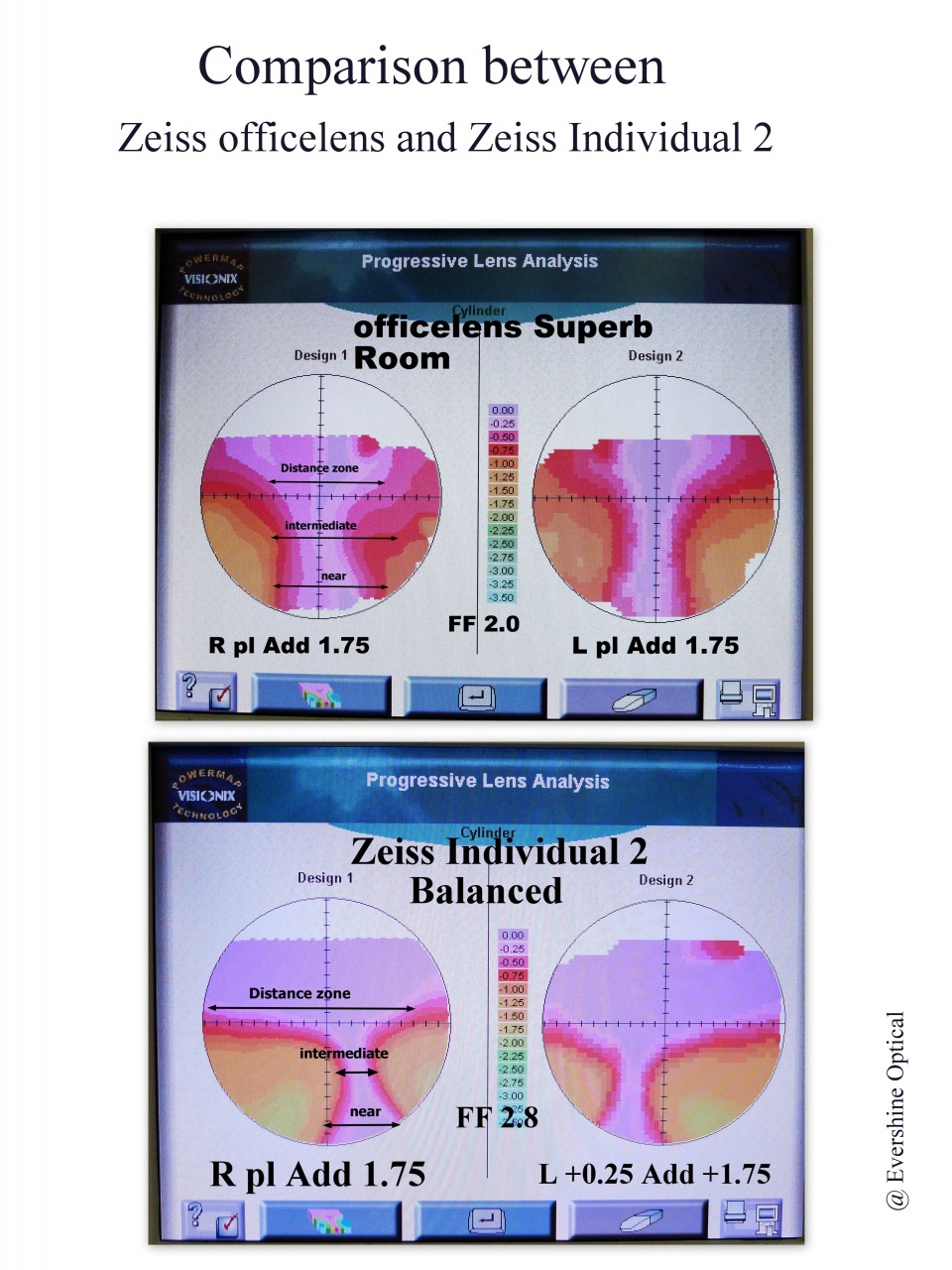 Case Study Progressive Lens — Optical X